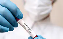 US to increase monkeypox vaccine supply