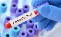 Day camp warns parents of camper infected with pertussis