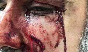 Haredi couple brutally beaten by protesters in Tel Aviv