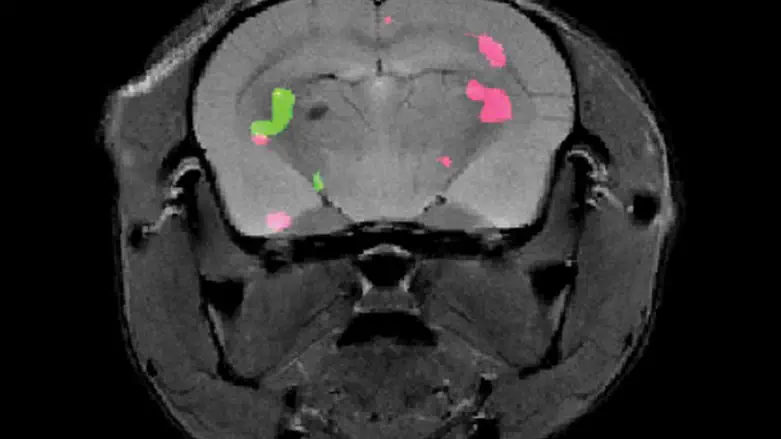 Two different proteins expressed in a mouse brain are revealed by dual-color MRI