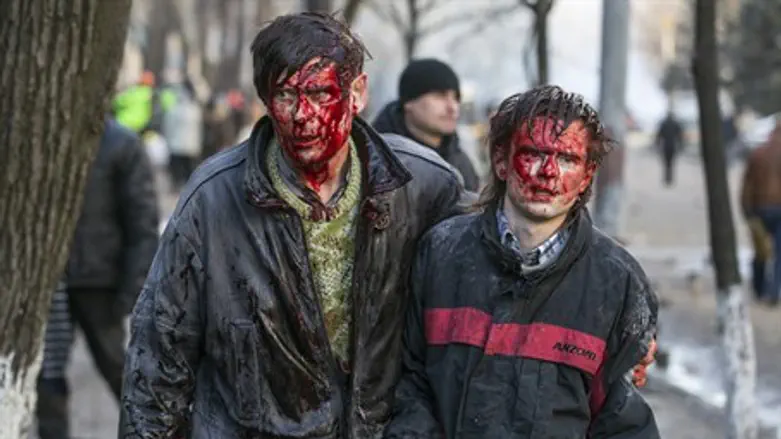 Walking wounded in Kiev