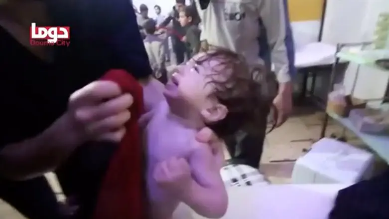 Douma baby receives treatment after chemical attack