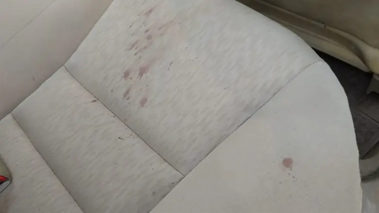 Blood stains on the vehicle's seat