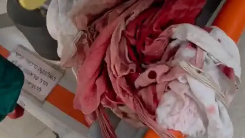 הטלית של אלחנן מגואלת בדם