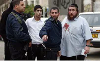 Jewish Man Injured in Shimon Hatzaddik Rock Attack