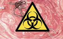 Dallas Hospital Worker Contracts Ebola Due to 'Protocol Breach'