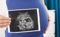California professor apologizes for saying 'pregnant women'