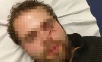Paris: Man beaten unconscious for being Israeli
