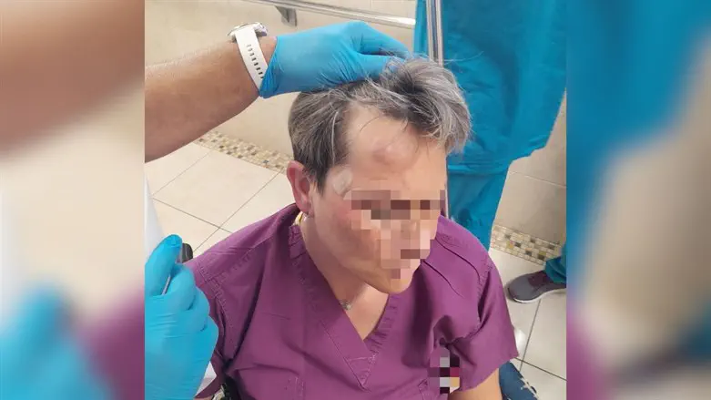 nursing assistant punched in the head
