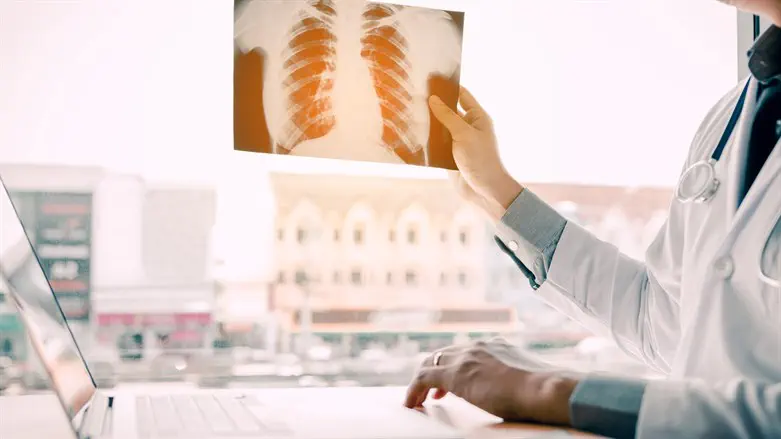 Considering a patient for lung transplant (illustrative)