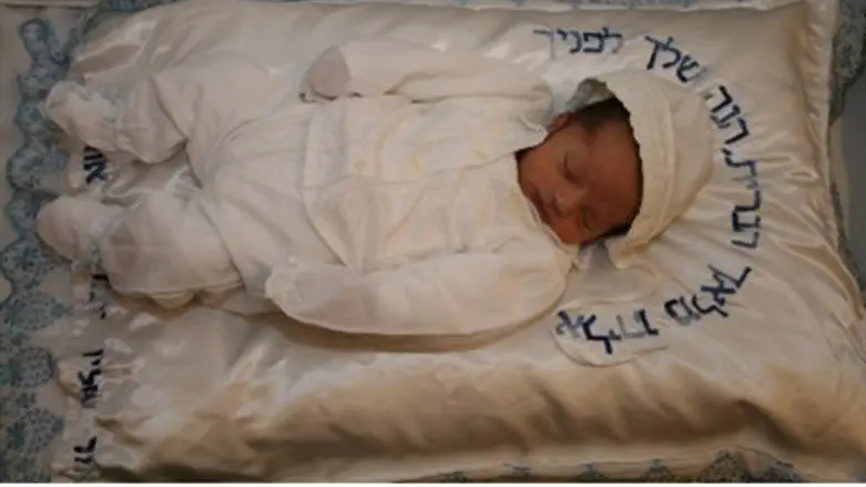 Baby on day of circumcision