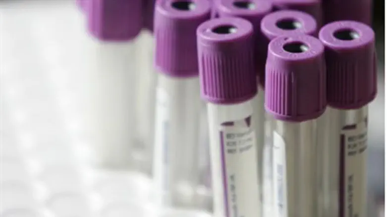 Blood tests (illustrative)