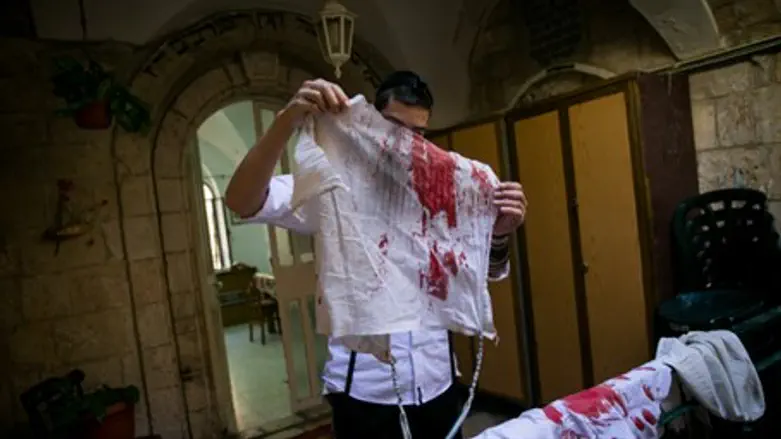Bloody tallit worn by stab victim