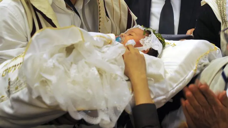 circumcision
