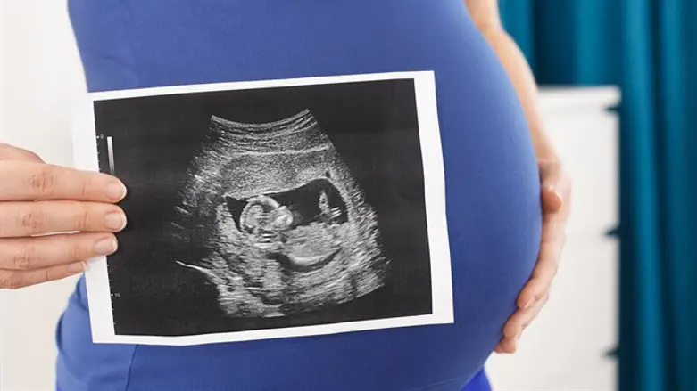 Pregnant woman (Illustrative)